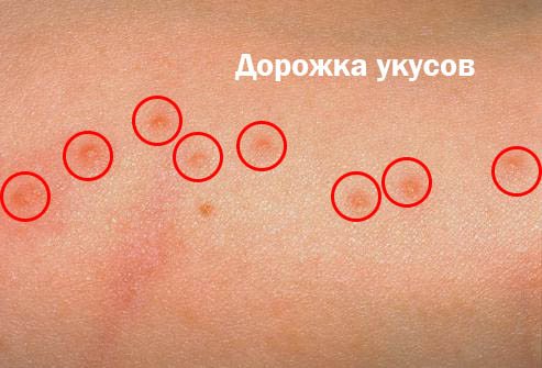 Быть или не быть постельным клопам и чего они боятся: вот в чем вопрос!