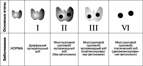 Причины, симптомы, диагностика и лечение эндемического зоба