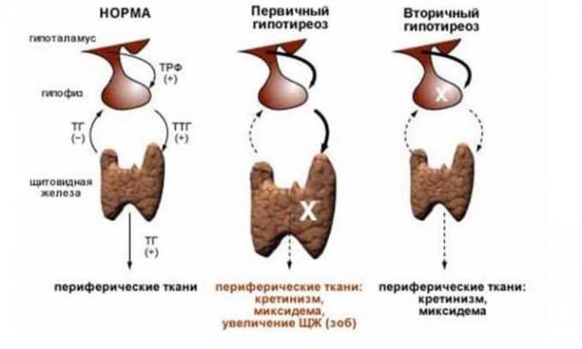 Дипроспан