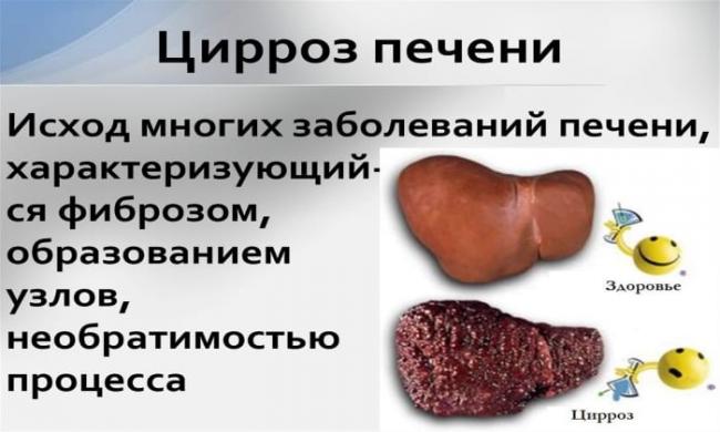 Тиоктовая кислота: показания к применению