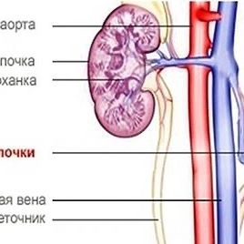 Опущение почки 2 степени