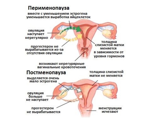 Оптимальные методы восстановления месячных