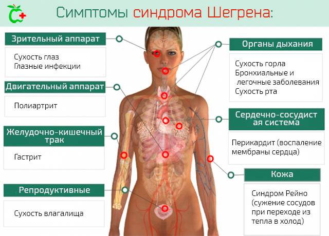 Покраснение глаз