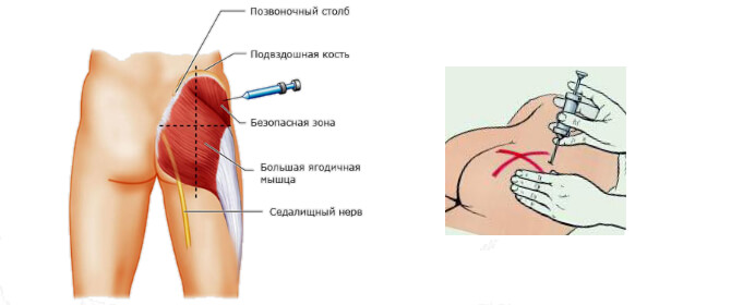 Простакор