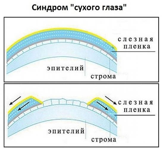 Лавиталь