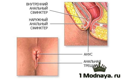 От чего печет в заднем проходе. почему чешется в заднем проходе: причины зуда и лечение