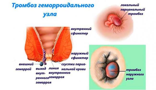 Гепазолон (hepazolon) инструкция по применению