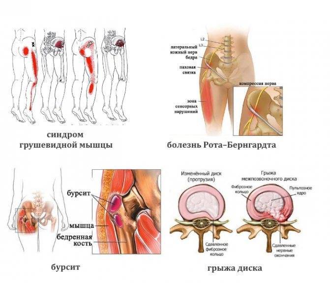 Осложнения на ноги у ребенка после орви