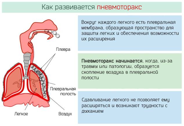 Табакокурение и активный туберкулез: влияние и лечение