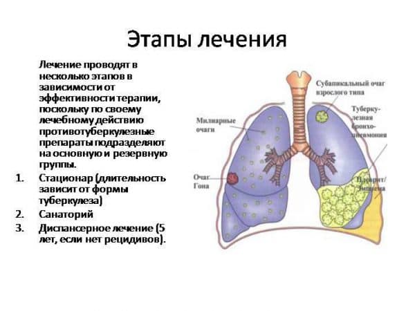 Туберкулез: пути передачи, симптомы, профилактика