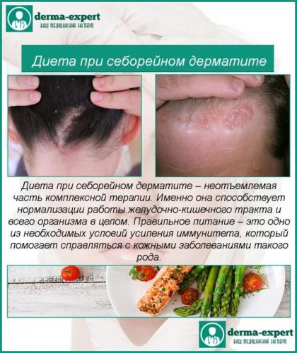 Диета при периоральном дерматите на лице
