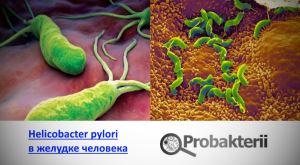 Зачем нужны и чем опасны бактерии для желудка