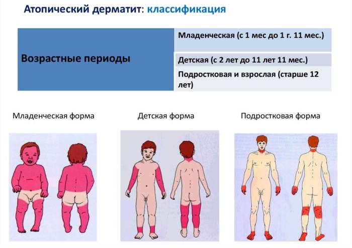 Диагностика и профилактика туберкулеза
