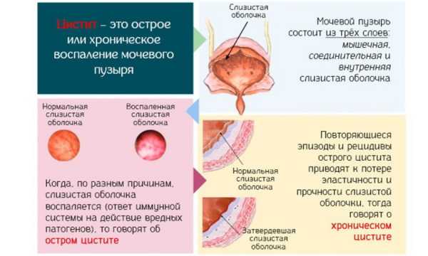 Ольга бутакова: важно! бактерии, с которыми мы встречаемся каждый день