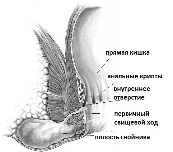 Парапроктит