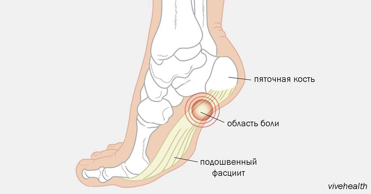 Почему у ребёнка температура и болят ноги