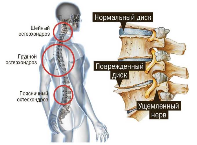 Топ заменителей лекарства артра: 12 лучших аналогов