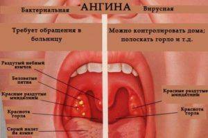 При простуде лучше клюква или брусника