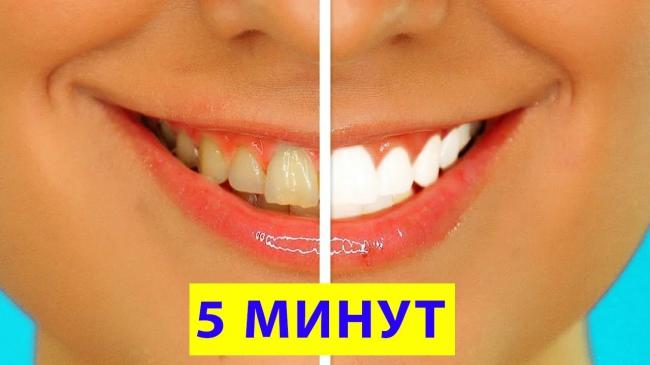 Лазерное отбеливание зубов