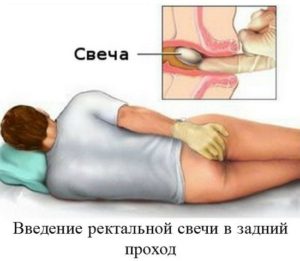 «облепиховое масло»: полезные свойства и противопоказания, цена в аптеке, сколько стоят аналоги
