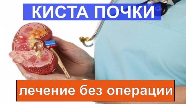 Паренхиматозная киста почки