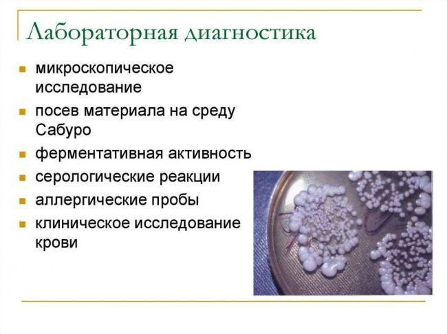 Свойства и особенности патогенных микроорганизмов, их влияние на человека