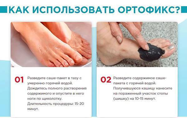 Препарат ортофикс инструкция по применению