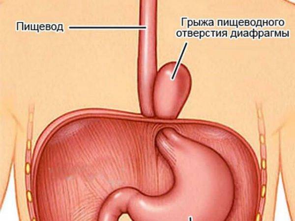 Кашель по ночам першение в горле у взрослого причины