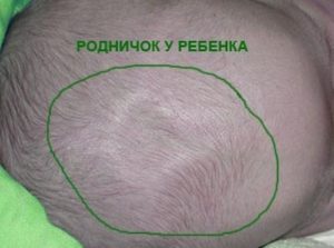 Зарос родничок. - когда зарастает родничок у новорожденного - запись пользователя марья (maria2310) в сообществе здоровье новорожденных в категории разное - babyblog.ru