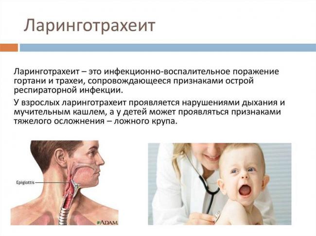 Ложный круп у детей: что это такое, симптомы и лечение, признаки, причины и неотложная помощь
