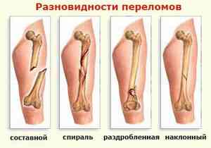 Ложный круп у детей – как определить и вылечить заболевание?