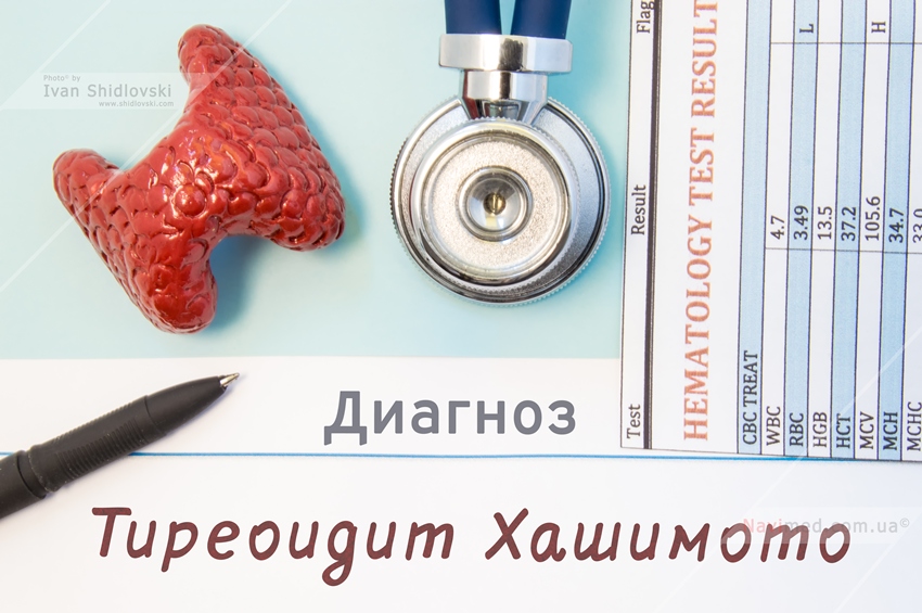 Подострый тиреоидит