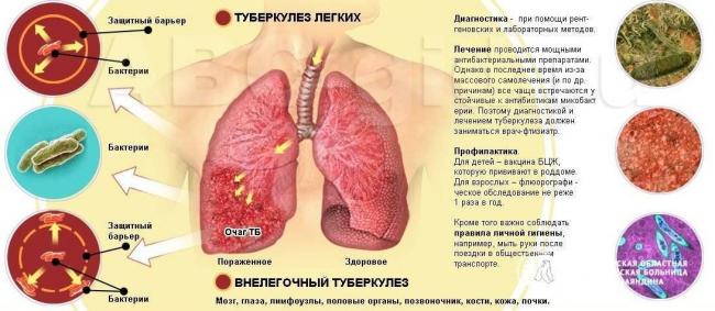 Противопоказания манту у детей: реакция на пробу, осложнения