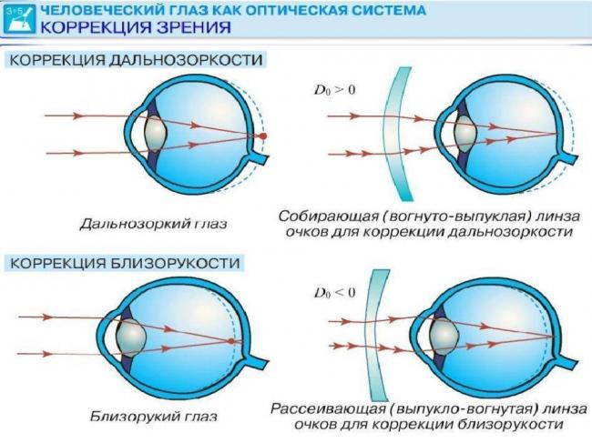 Ухудшение зрения: почему падает после 40-45 лет и что с этим делать?