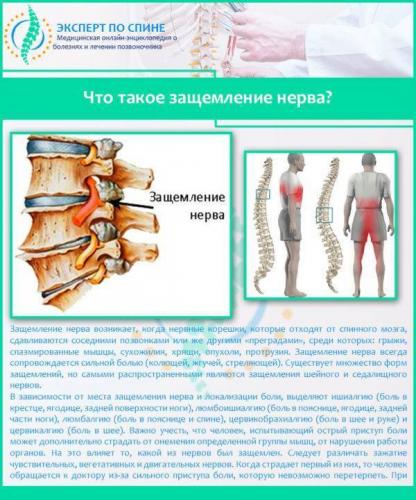 Защемление нерва между лопаткой и позвоночником лечение