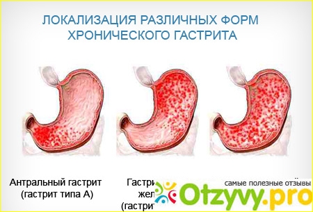 Аналог таблеток ребагит