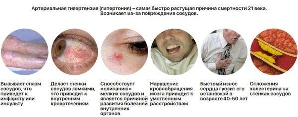 Вамлосет - инструкция по применению, аналоги, отзывы и формы выпуска таблетки 580 мг, 5160 мг, 5320 мг, 10160 мг и 10320 мг препарата для лечения гипертензии и снижения давления у взрослых, детей и при беременности