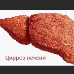 Что будет с печенью если пить каждый день пиво или водку?