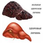 Вредно ли пиво для печени?
