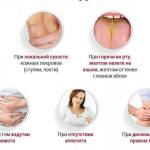 Первые признаки заболевания печени у женщин