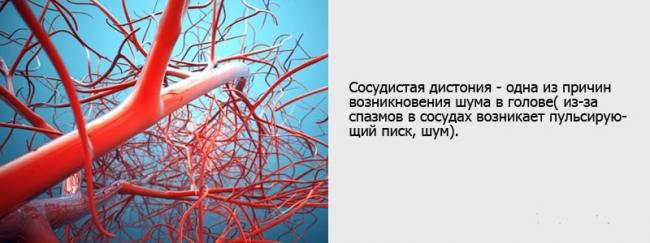 Звон в ушах