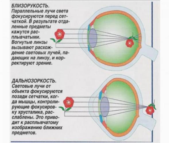 Оправы для очков женские для зрения