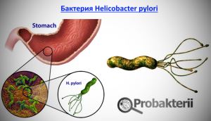 Зачем нужны и чем опасны бактерии для желудка