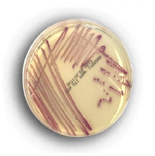 Escherichia coli 10/6 в моче - запись пользователя summer (id2122363) в сообществе благополучная беременность в категории анализы - babyblog.ru