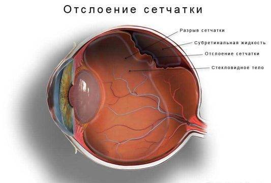 Пленка на глазу человека причины и лечение