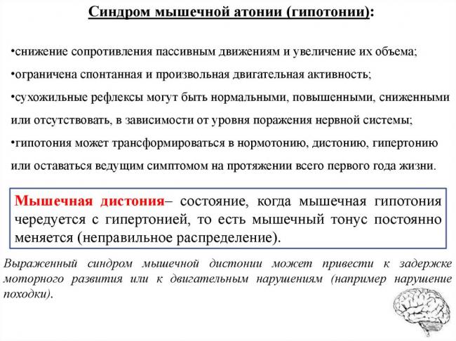 Сенситивная атаксия при рассеянном склерозе