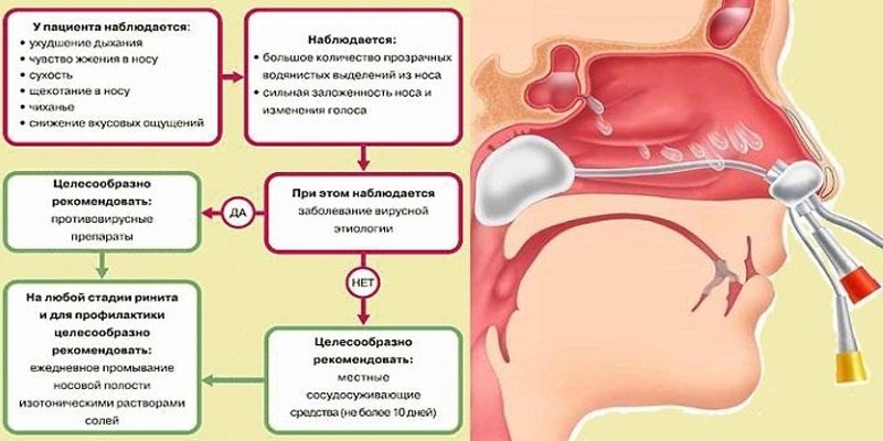 Лечение вазомоторного ринита в домашних условиях