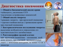 Какой анализ крови показывает пневмонию. анализы мочи и крови при пневмонии - значение показателей