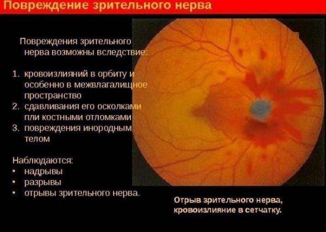 Софрадекс в нос ребенку