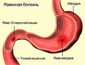 Холагол: инструкция по применению